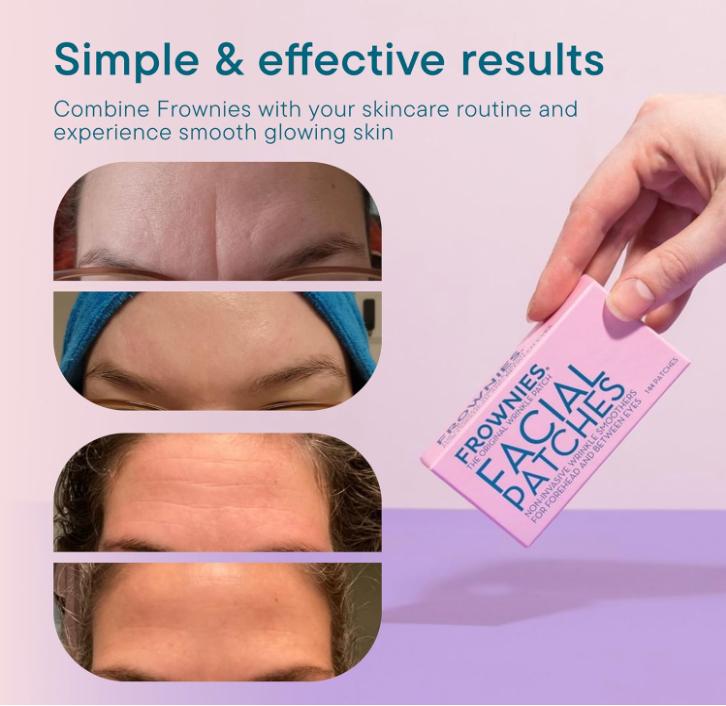 PD Frownies Forehead and Between the Eyes Wrinkle Patches - Hypoallergenic Facial Patches to Smooth & Soften Forehead Wrinkles & Eleven Lines - For Overnight Use, 144 Patches Relaxing Comfort