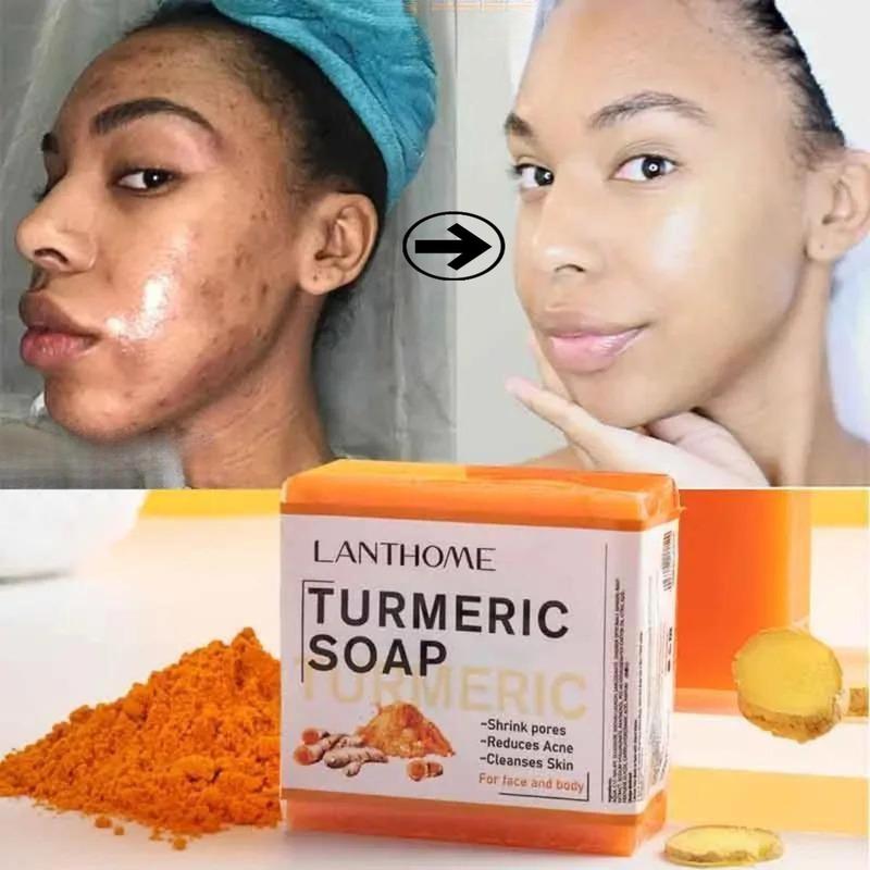 Turmeric Soap Bar For Face & Body,Turmeric Skin Soap Wash For Dark Spot, Intimate Areas, UnderarmsTurmeric Face Soap improving Acne & Cleanses Skin