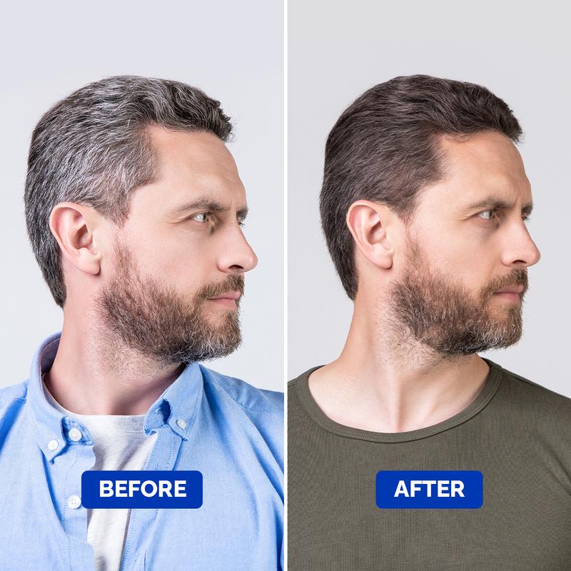 Anti-Gray Serum For Men | Reverse That Gray Hair Without Harsh Chemicals