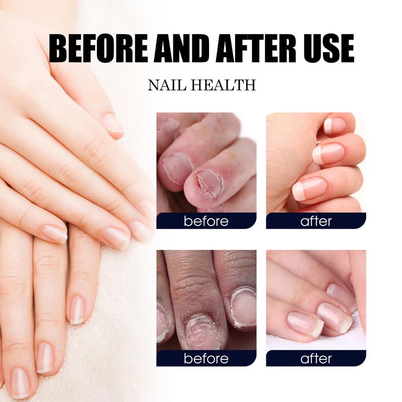 [Flash Deal] Plant Drops, Tea Tree, Oregano oil nail support Nail Care,10 ml 0.34 Fl.oz Nail Polish Comfort Manicure Nail Art