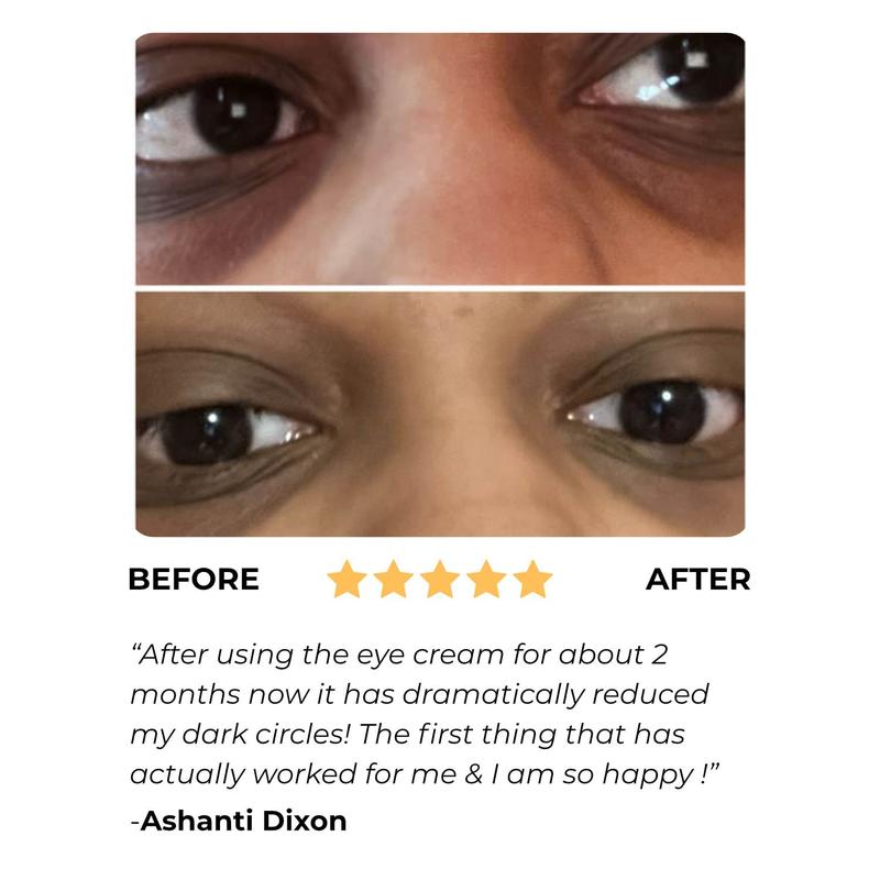 Under Eye Cream (for dark circles and puffiness)