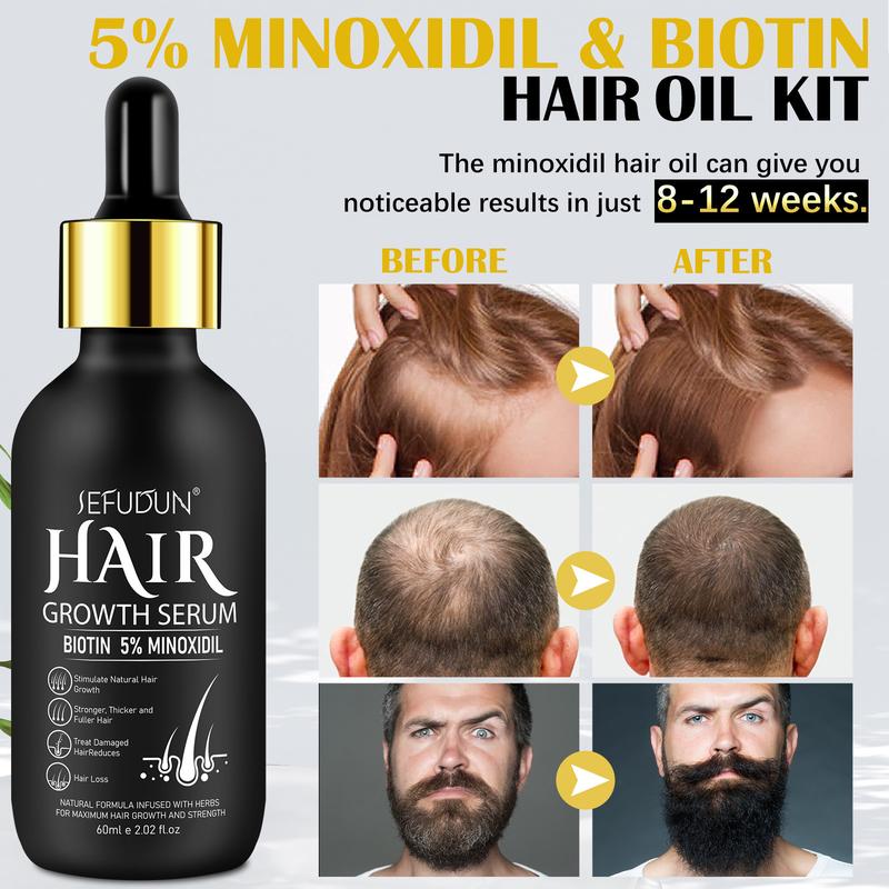 Sefudun 5% Minoxidil for Men and Women kit-Topical Serum for Scalp Hair Care or Longer Hair Care, Suitable for Thanksgiving Christmas Gift