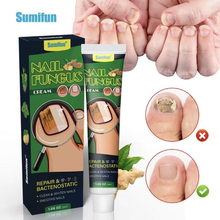 Healthy Nail Essencerepair gel, nail repair nail care nail art, treatmentof nail removal cream fungus infection paronychiaComfort Manicure Nail Polish ginger nail