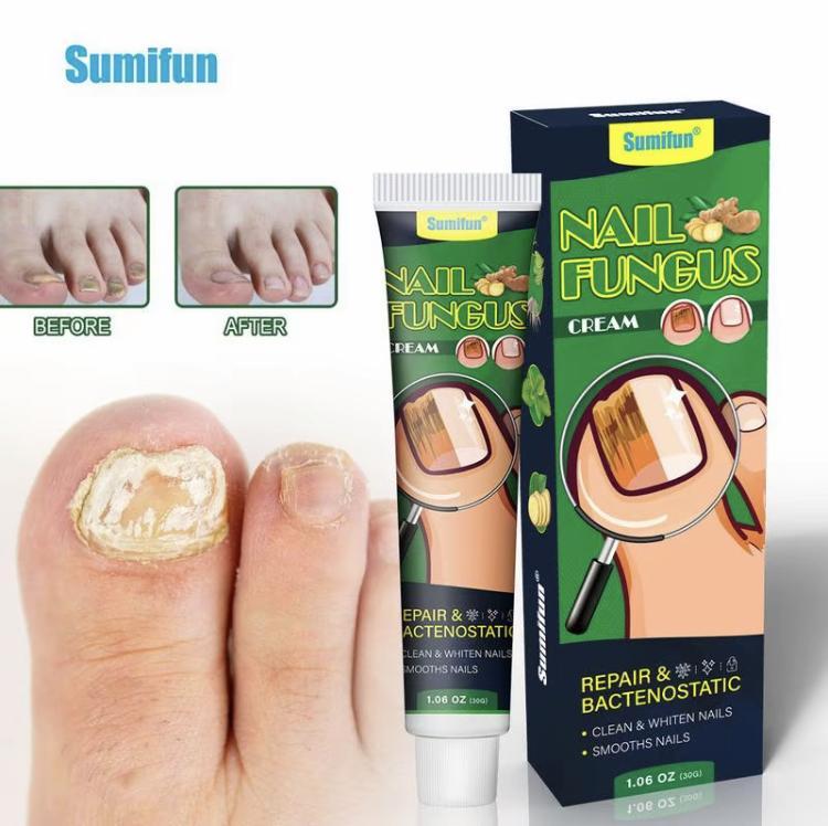 Healthy Nail Essencerepair gel, nail repair nail care nail art, treatmentof nail removal cream fungus infection paronychiaComfort Manicure Nail Polish ginger nail