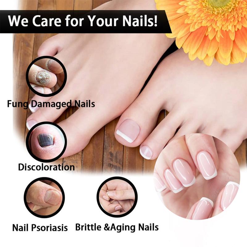 EELHOE Nail Repair Solution Thickening Bright Nails Remove Onychomycosis Dead Skin Repair Moisturizing Nail Art Nutritional Care Solution