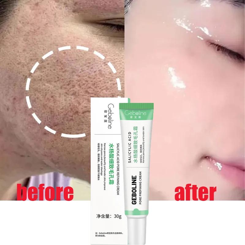 Salicylic Acid Pore Shrinking Cream Quick Elimination Large Pores Remove Blackehead Tighten Face Smooth Skin Korean Care Product