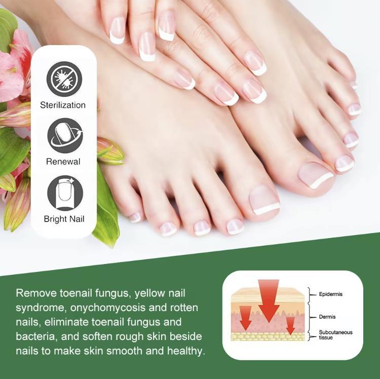 Healthy Nail Essencerepair gel, nail repair nail care nail art, treatmentof nail removal cream fungus infection paronychiaComfort Manicure Nail Polish ginger nail