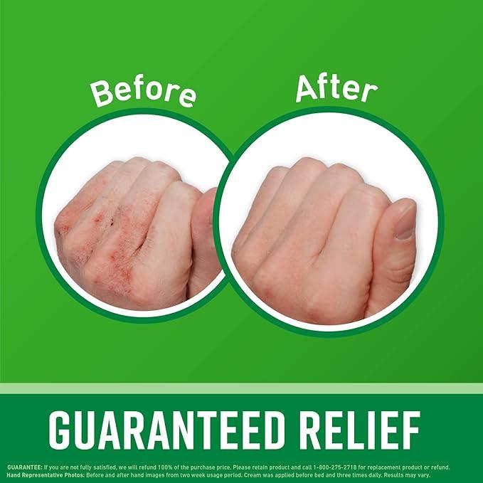 Working Hands Hand Cream; Relieves and Repairs Extremely Dry Hands; 3 oz Tube; (Pack of 2)