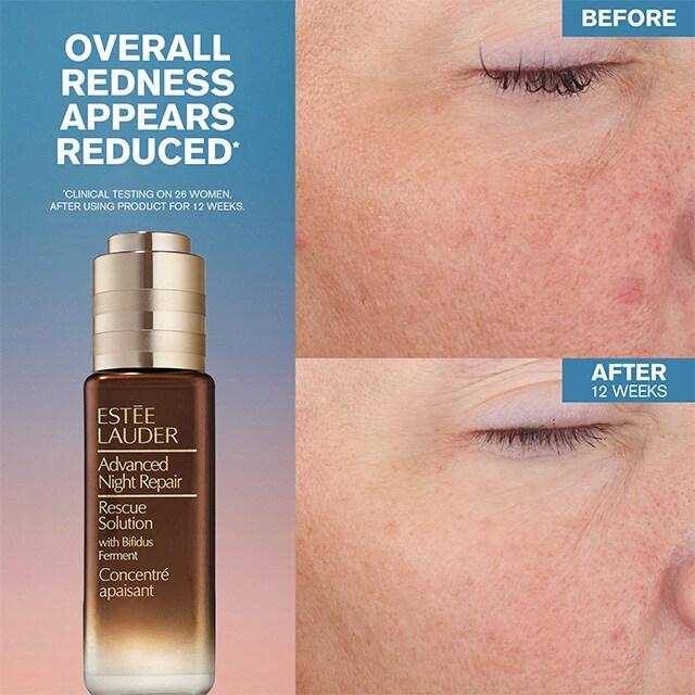 Advanced Night Repair Rescue Solution Serum with 15% Bifidus Ferment