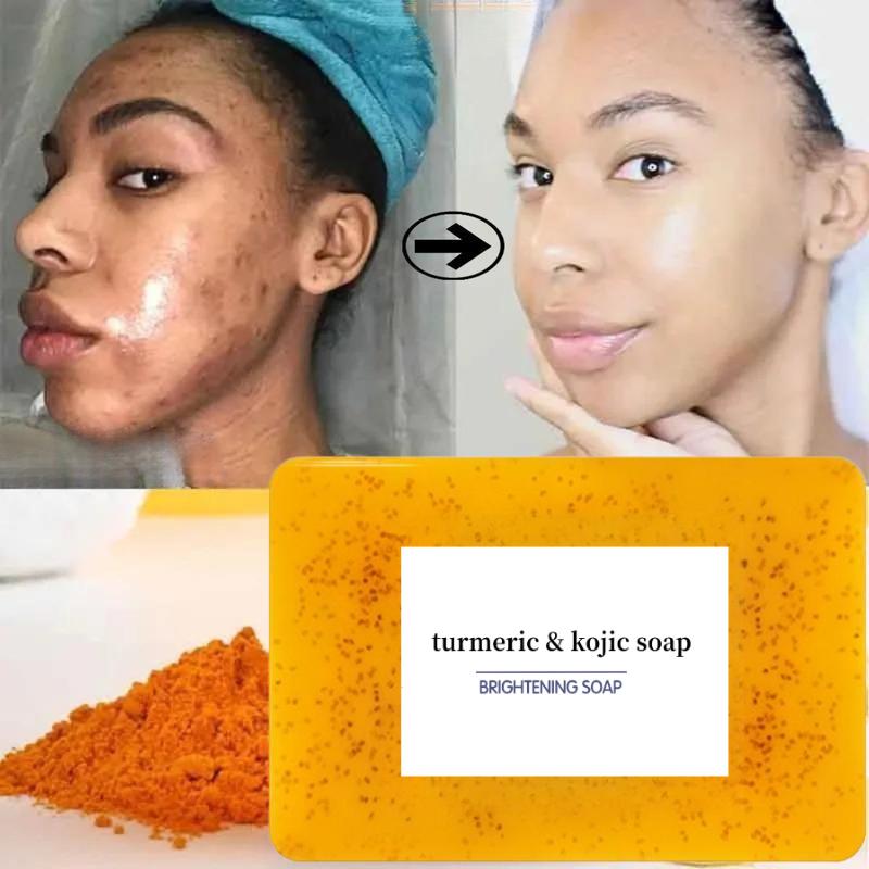 Turmeric & Kojic Acid Soap – Kojic Acid Soap for Body and Face Care, Lemon Body Wash for Flawless Skin, Organic Facial Cleanser, Skin Repair & Comfort, Helps Even Skin Tone