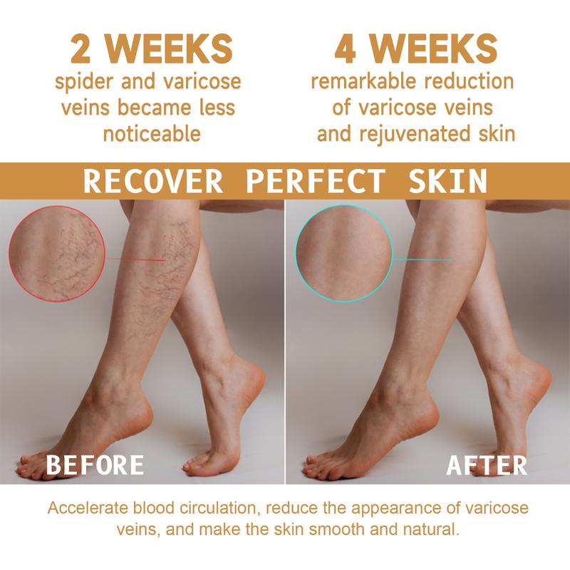 Intensive Veins Relief Cream-Leg Vein Repair Cream-Vitamin K Vein Care Ointment- Leg Veins Massage Cream