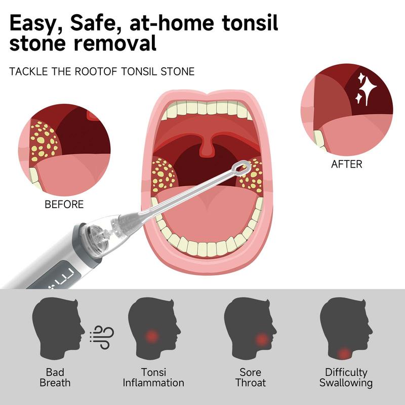 Oral Care Kit,  Vacuum Tonsil Stone Removal Kit, 8 Suction Mode, Built-in LED Light, Fight Bad Breath, Oral Irrigator, Tonsil Cleaner, Tongue Scraper