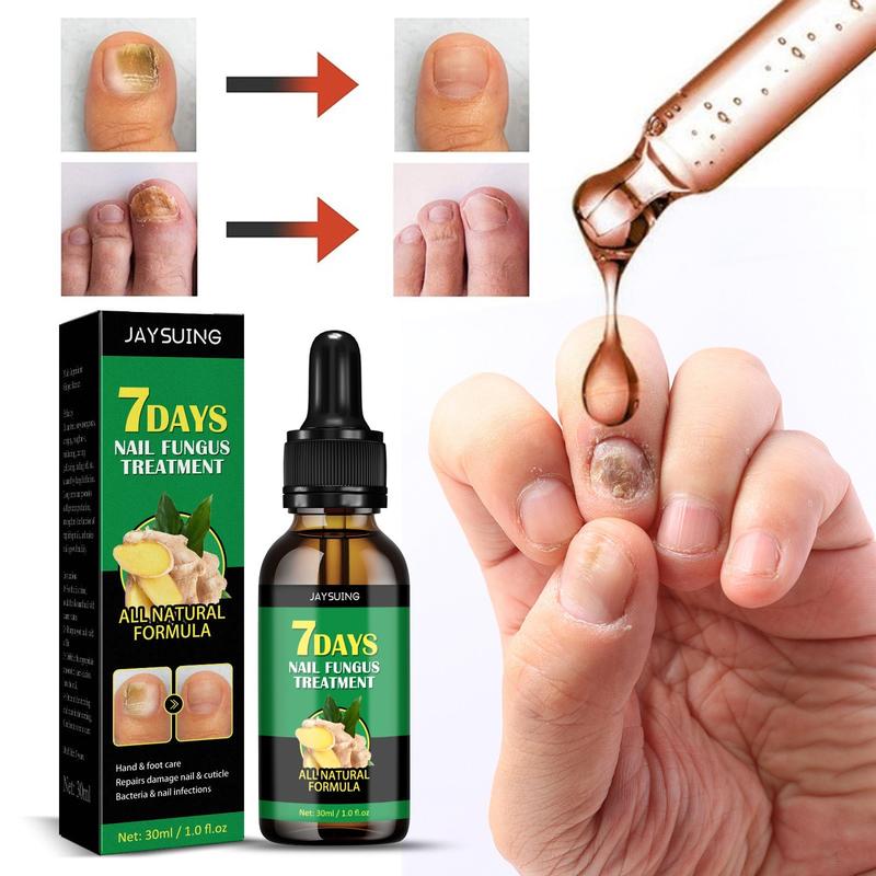 Ginger Nail Treatment  Multi-Purpose Nail Repair Solution for Discolored and Damaged nail oil