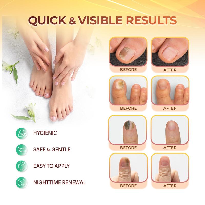 Fungal Nail Patches: Nail Fungus Relief - Toenail Fungus Relief - Nighttime Renewal Fungal Nail Patches - Nail Fungus Improvement - Overnight Nail Repair - 8-Hour Nighttime Renewal - 21 PCS Nail Care Smooth