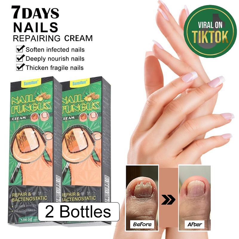 [Free Shipping] 2-Pack Nail Repair Cream Organic Nail Care, 7-Day Nail Repair Helps Soothe & Repair Damaged Nails, Prevents Fungal Growth, and Restores Nail Health