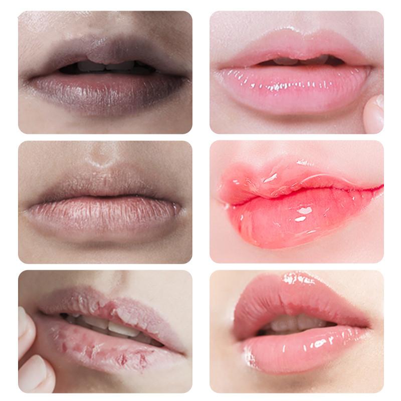 Fast Lightening Pink Mouth Lips Serum Permanent Pinkish Moisturizing Lighten Dark Lip Balm Gloss Lipstick Lip Mask13ML