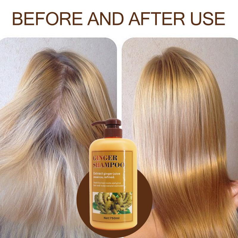 [FDA approved] 750ml Ginger Hair Shampoo Fast Regrowth Hair Thick Anti-Hair Loss Anti-Dandruff Anti-itching Shampoo