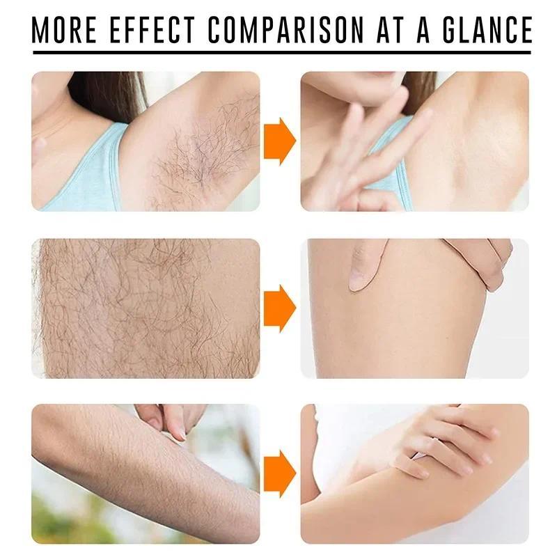 Women Intimate Area Depilatory Paste Men Armpits Leg Hair Removal Cream Body Painless Fast Depilatory Cream Face Hair Remover