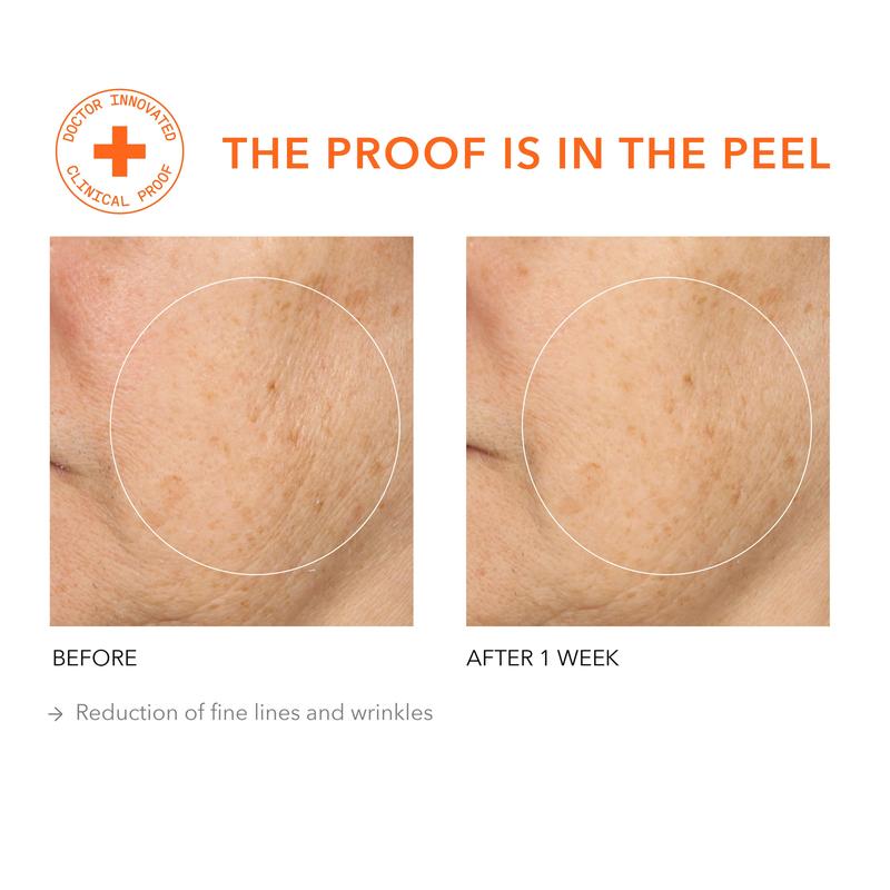 Alpha Beta® Universal Daily Peel