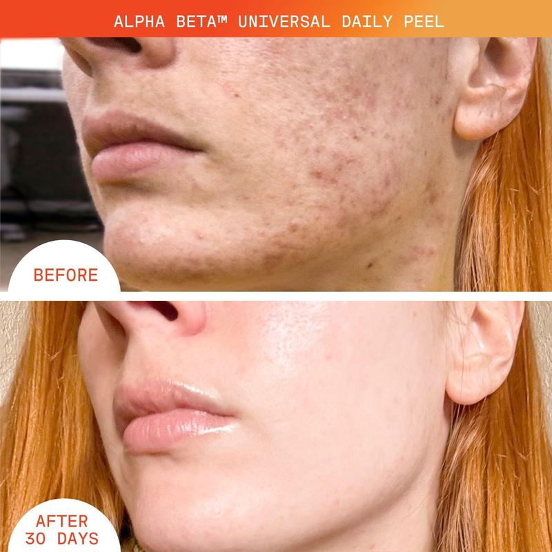 Alpha Beta® Universal Daily Peel